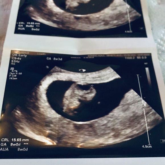 Meet your Posher, Jayden - Picture 1 of 1